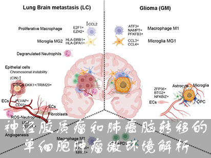 【烈冰助力】神經膠質瘤和肺癌腦轉移的單細胞腫瘤微環(huán)境解析